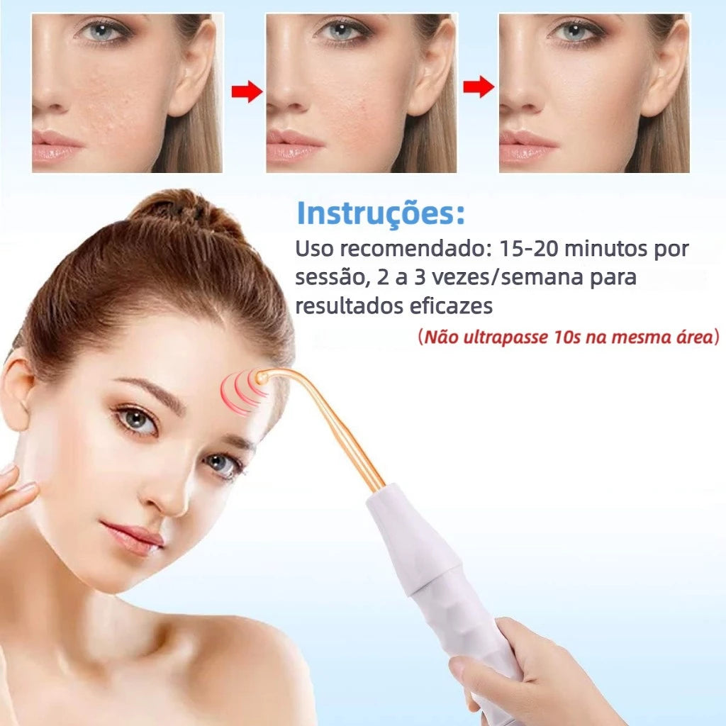 Aparelho de Alta Frequência Limpeza De Pele 5 em 1 | Limpeza Facial e Tratamento Capilar Cuidados Com A Pele Do Rsto